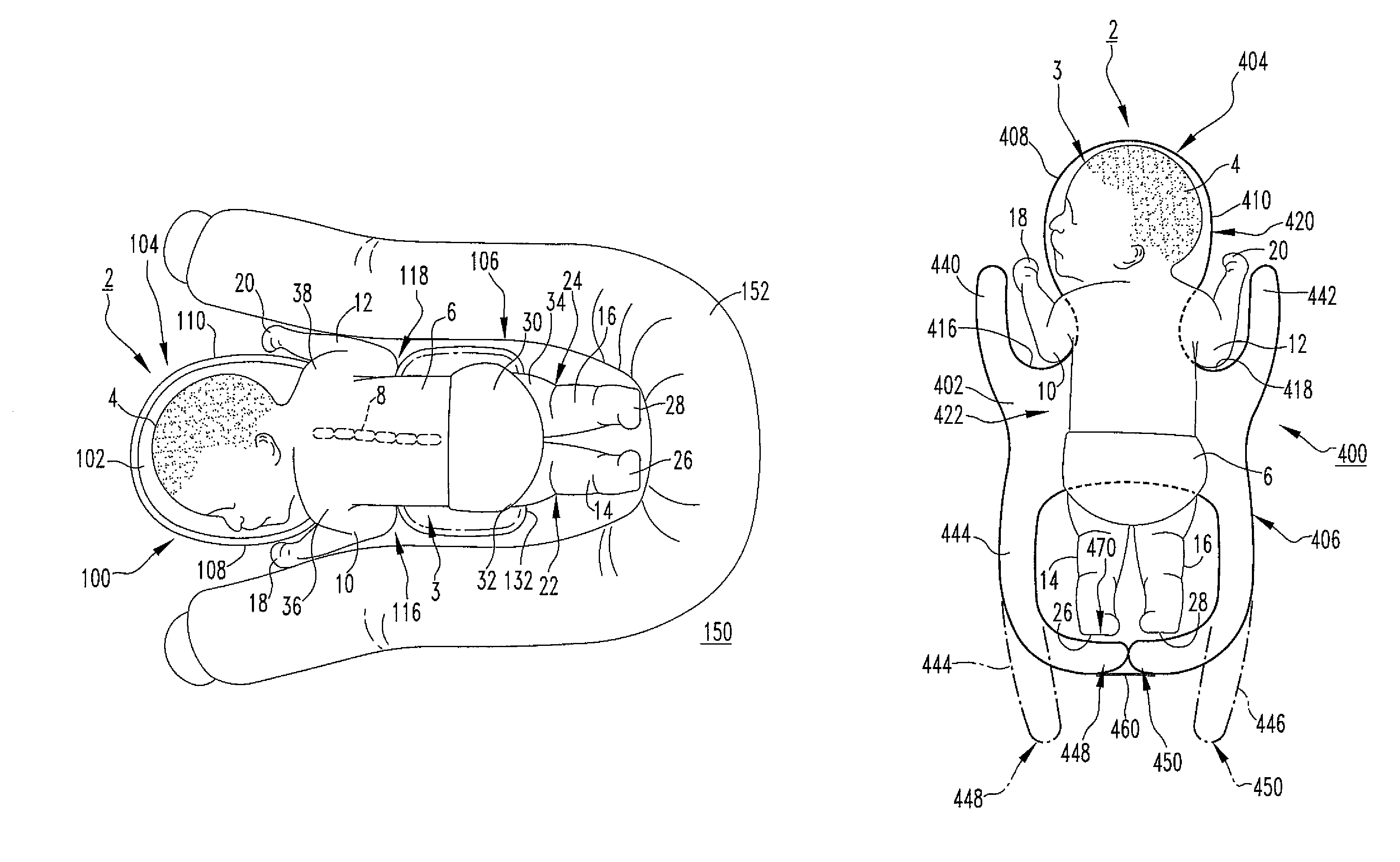 Infant positioning system and prone positioning apparatus therefor