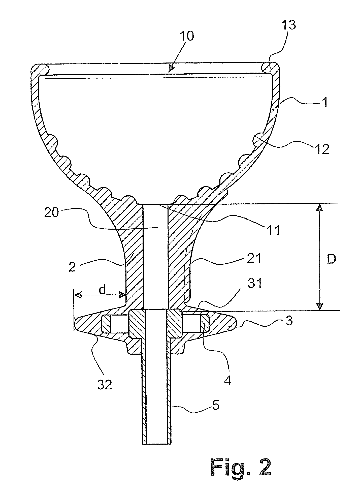 Obstetric Delivery Device