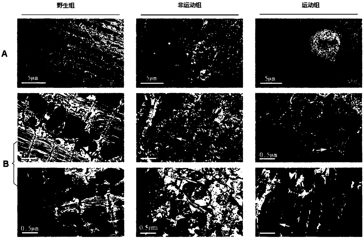 Application of HDAC4 inhibitor in preparing medicine for treating heart failure