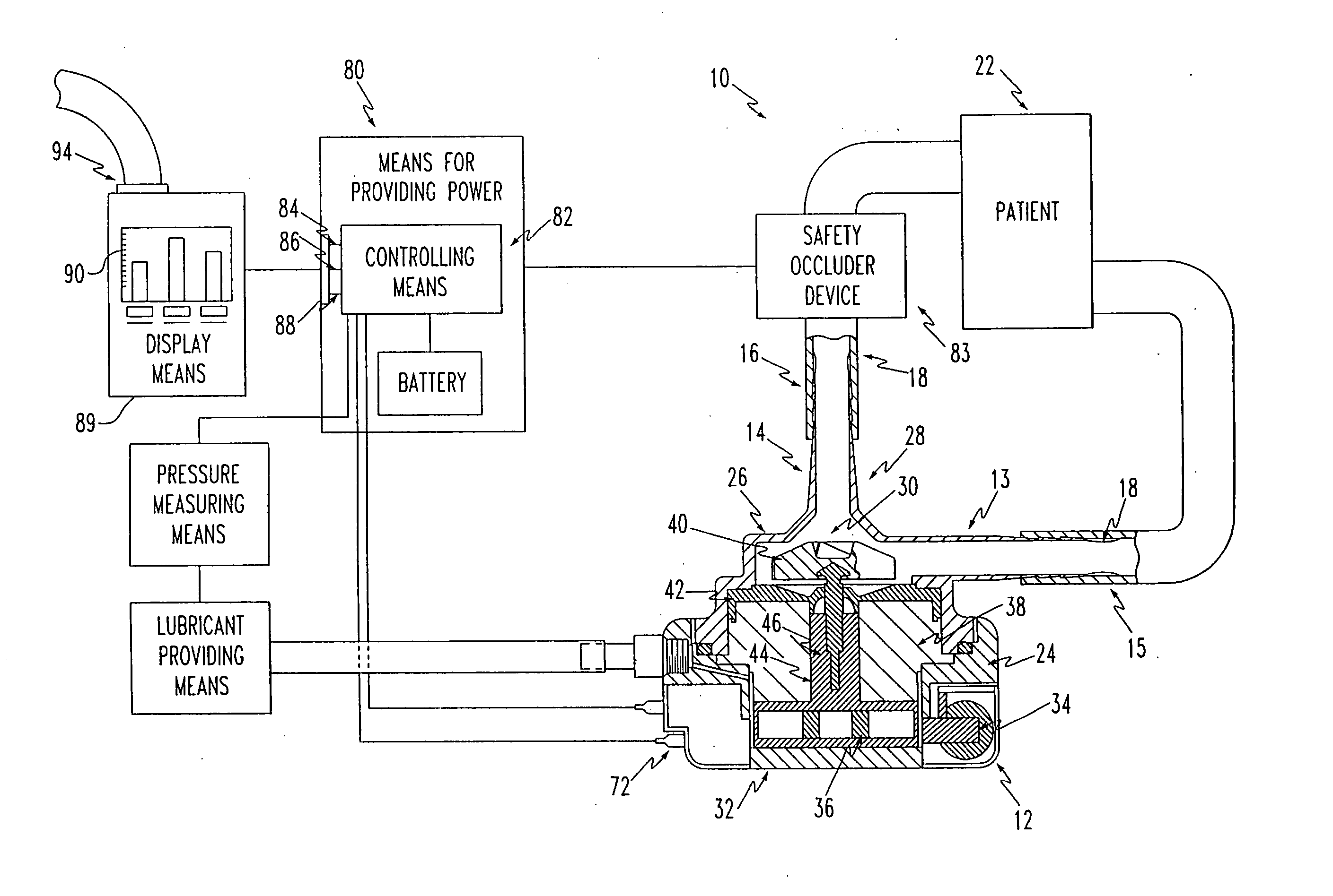 Blood pump device and method of producing