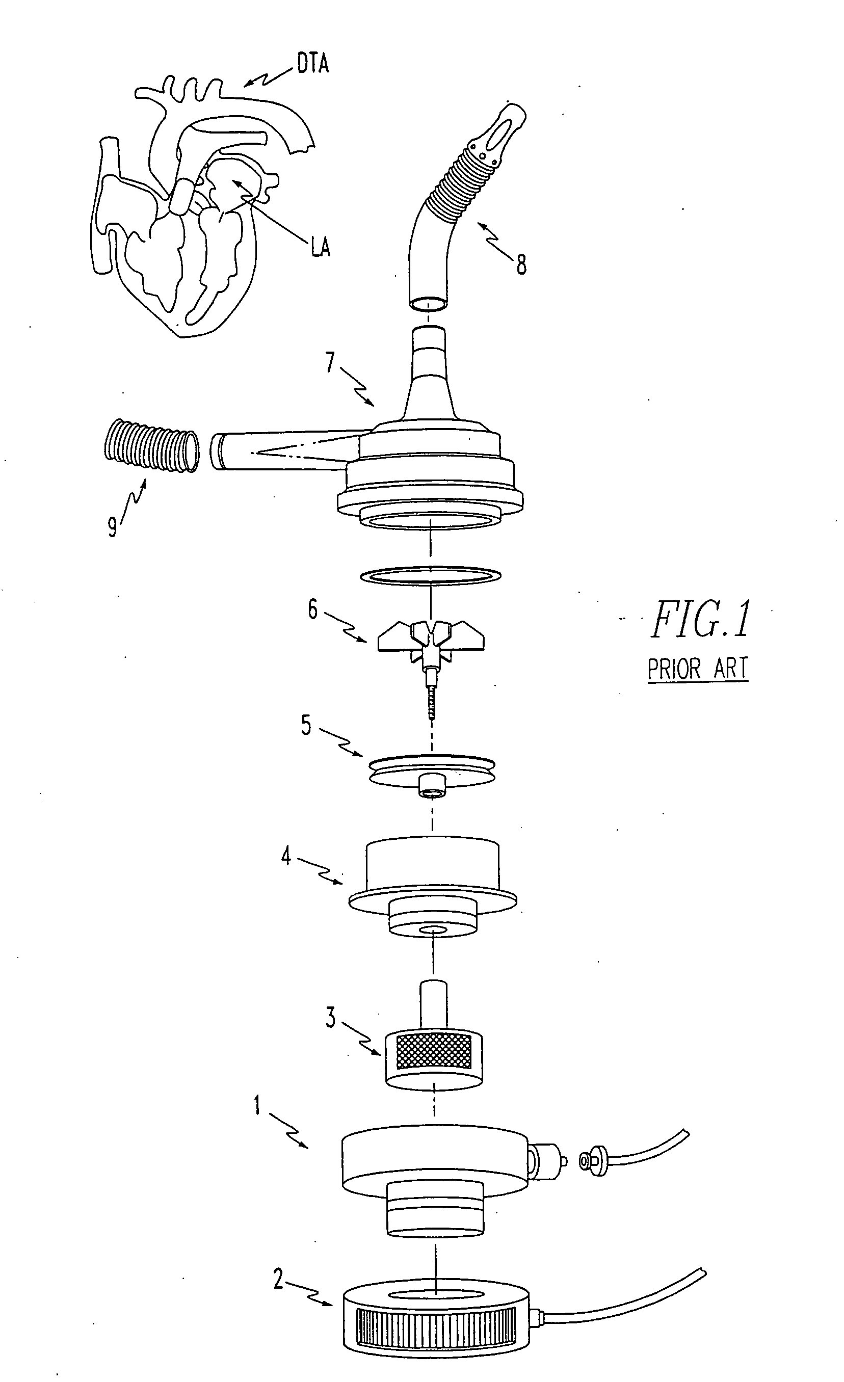 Blood pump device and method of producing