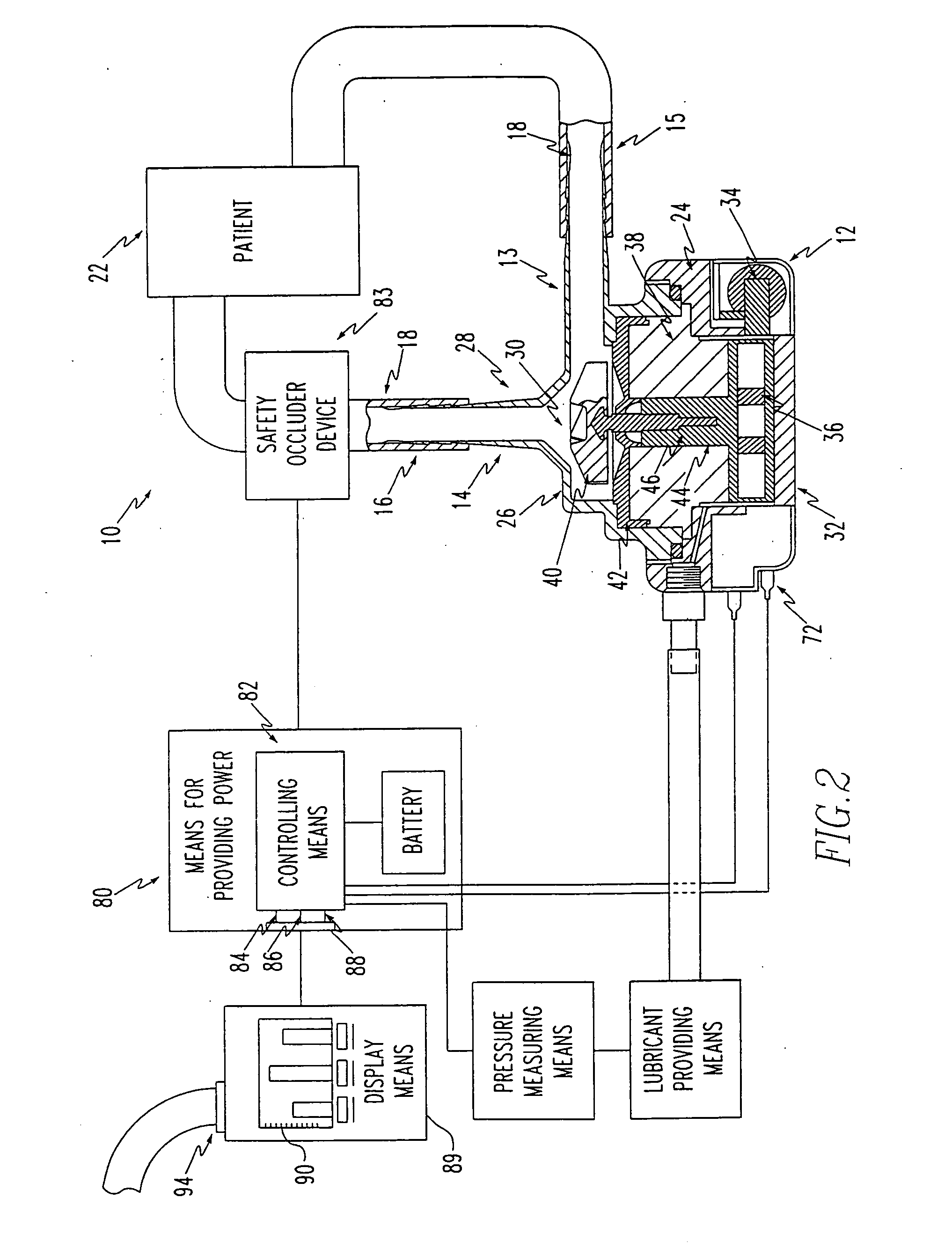 Blood pump device and method of producing