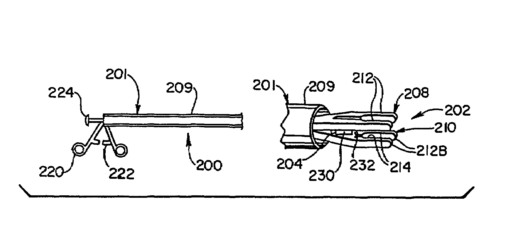 Apparatus and method for vein removal