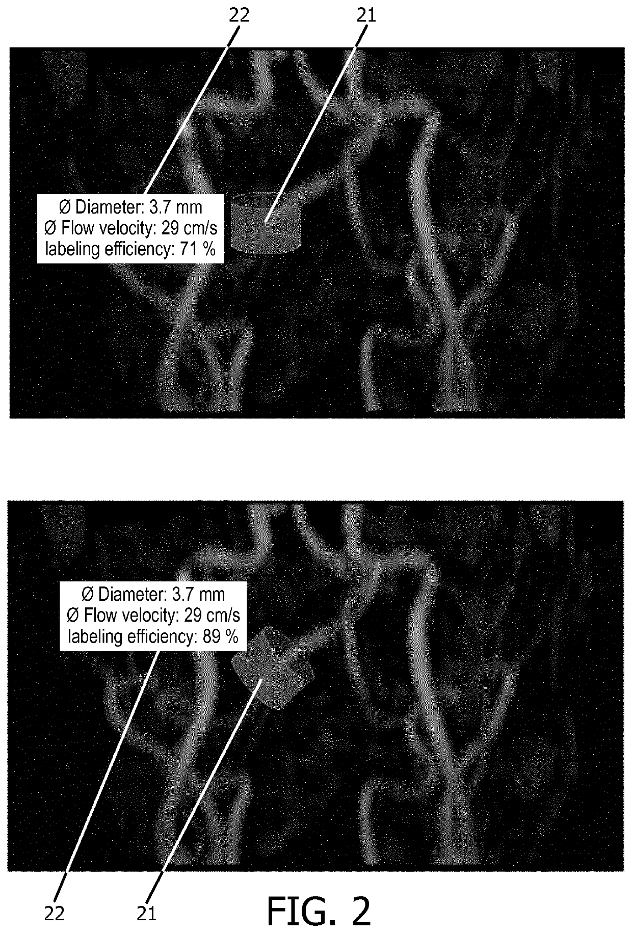 Planning support for selective arterial spin labeling mr imaging methods