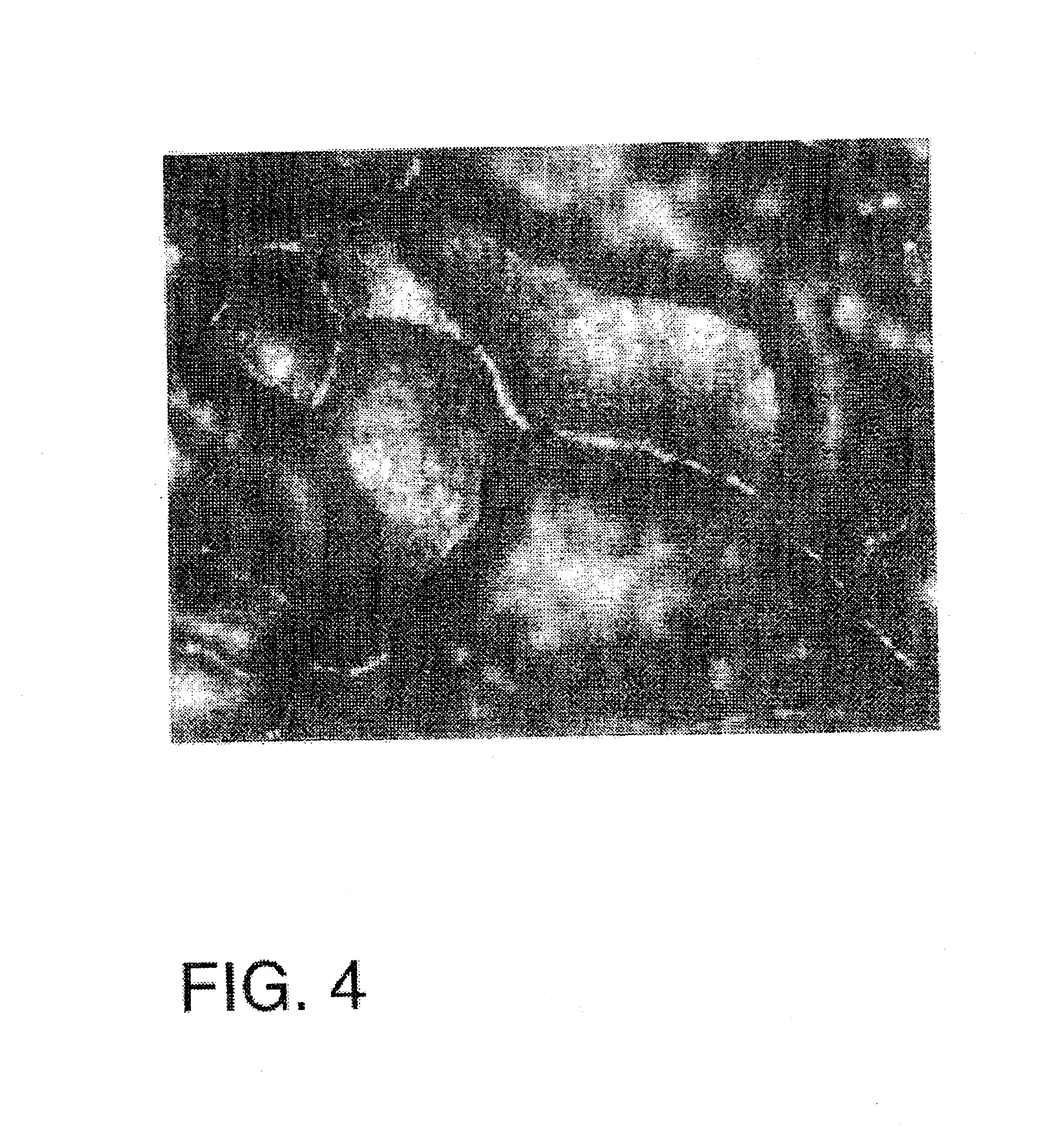 Surface for use on implantable device