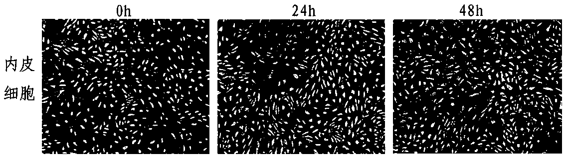 Cancerous human umbilical vein endothelial cell vaccine and application thereof in resisting cancers