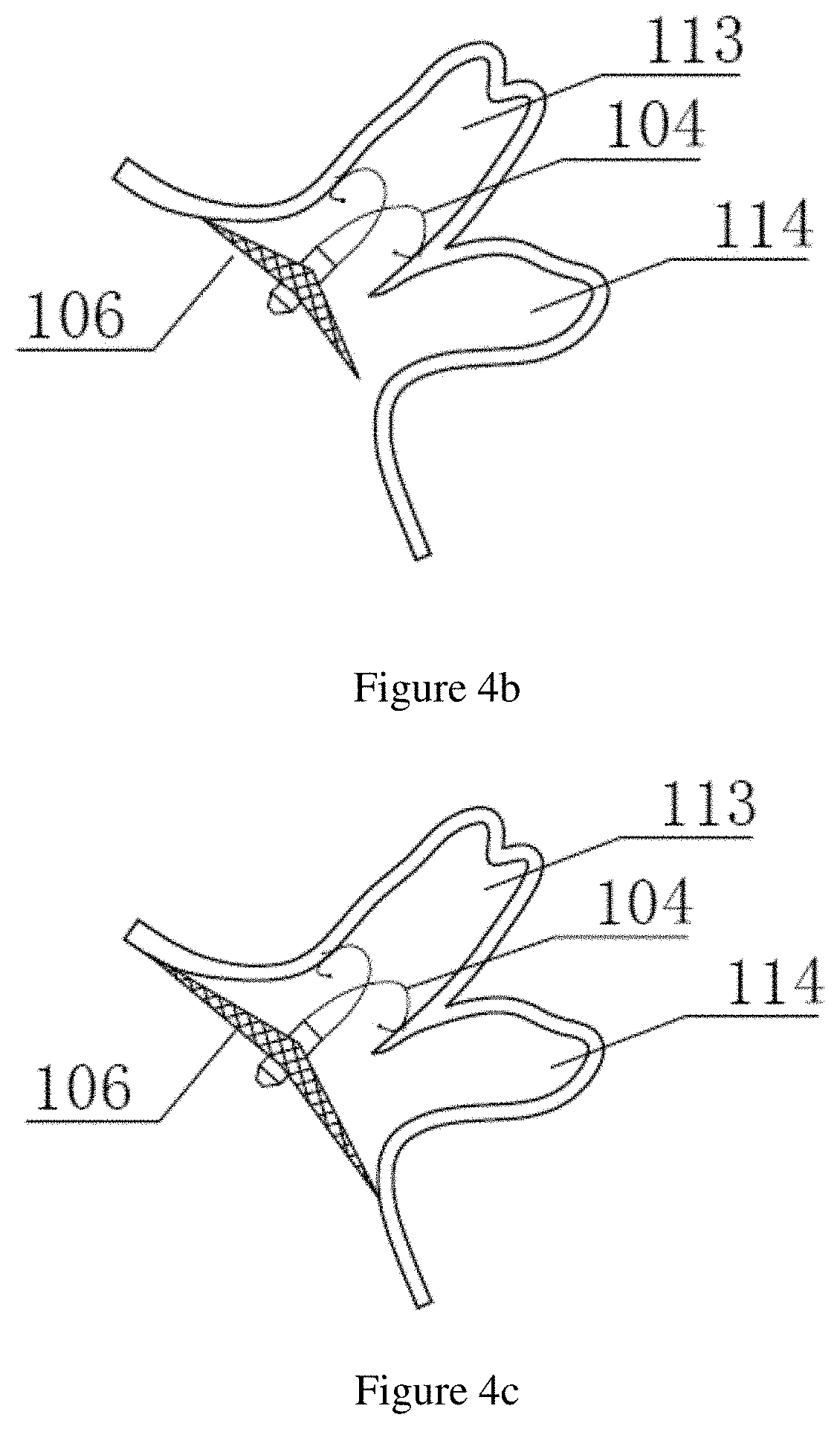 Left atrial appendage closure apparatus