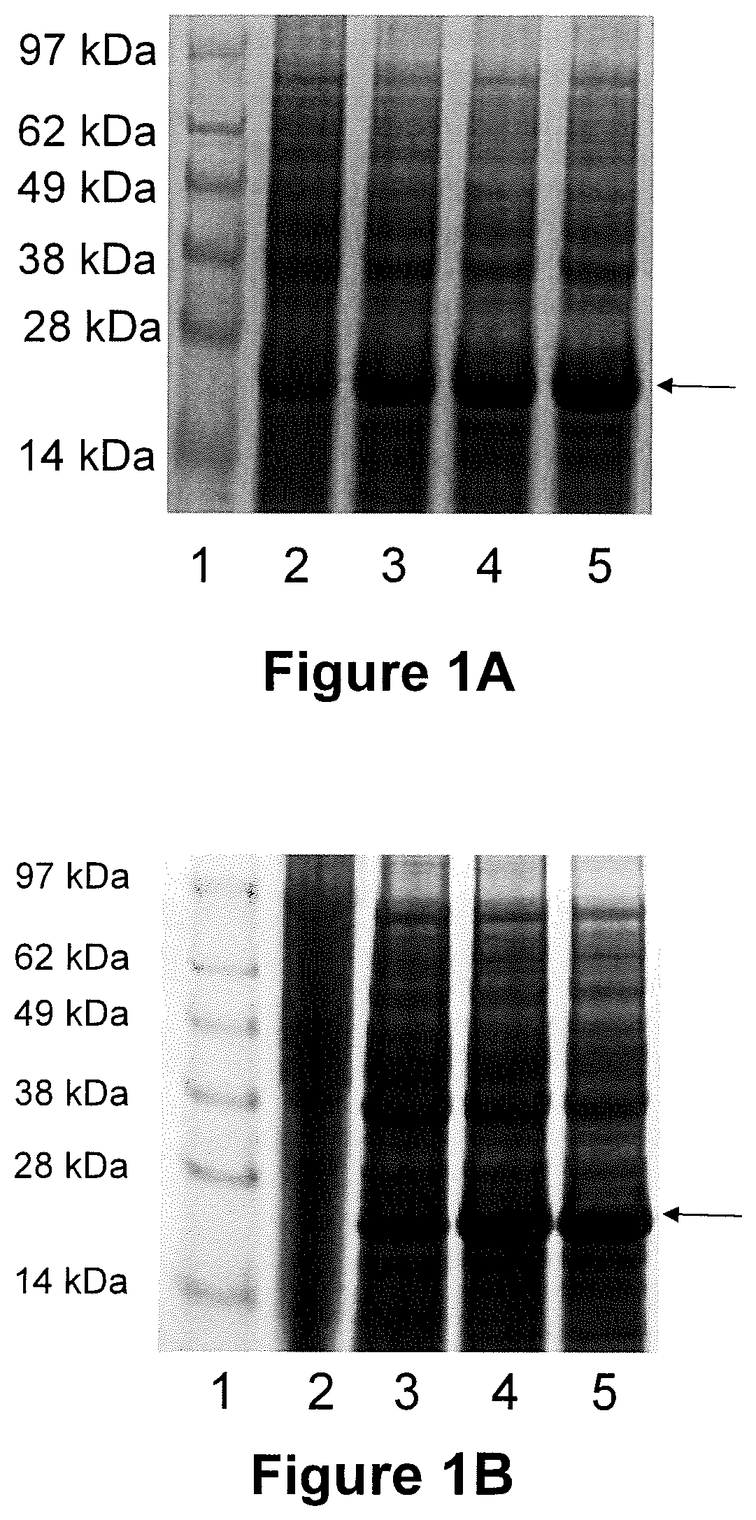 Chimeric vaccine antigens for anaplasmosis