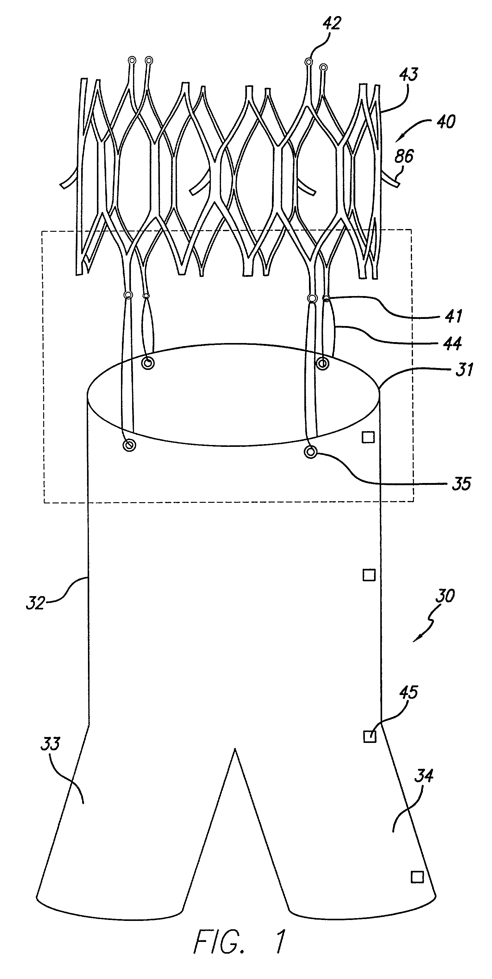 Endovascular graft device and methods for attaching components thereof