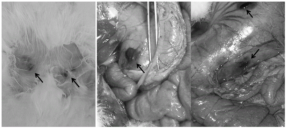 Application of pixantrone serving as lymphatic tracer