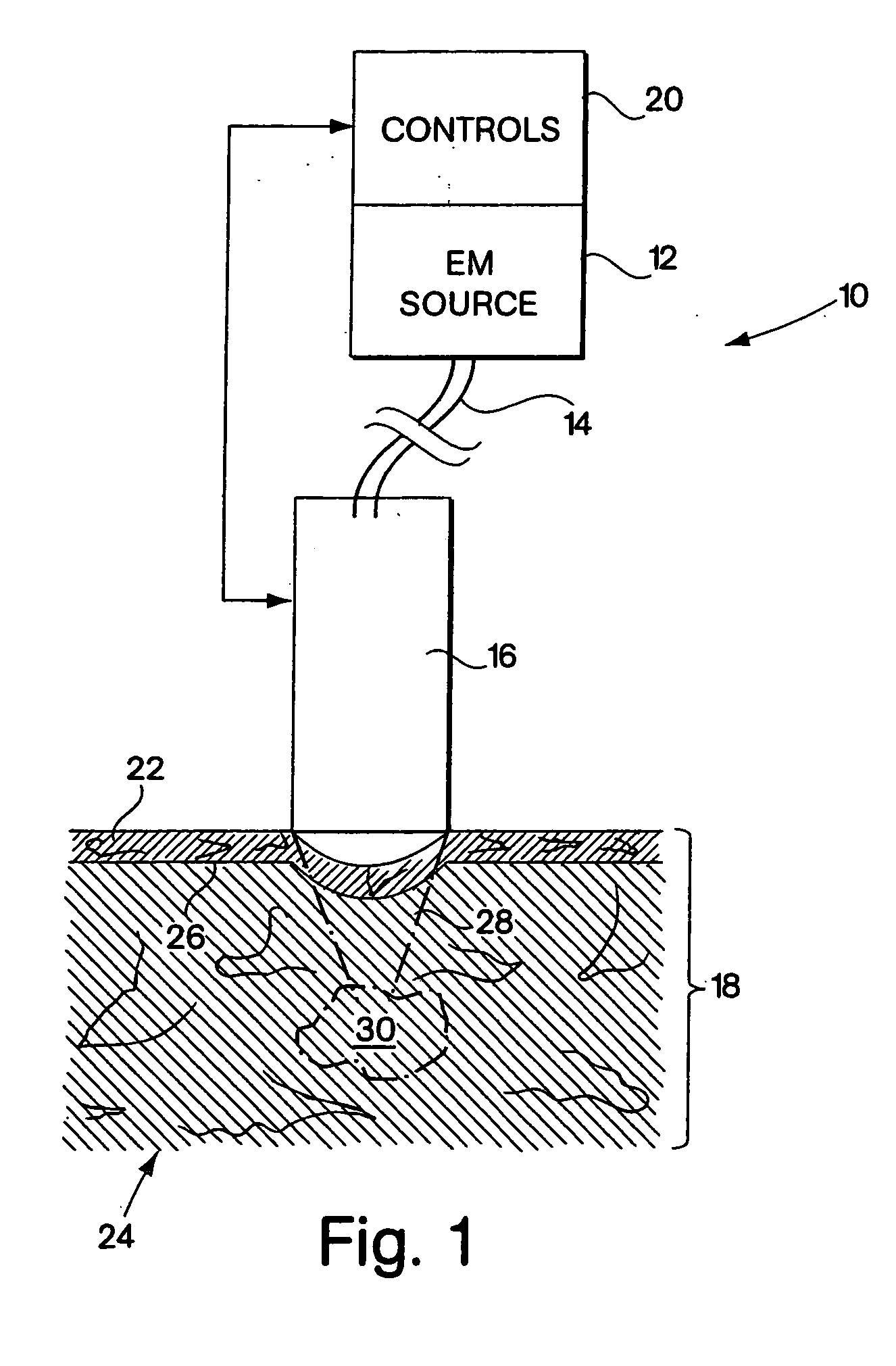System for electromagnetic radiation dermatology and head for use therewith