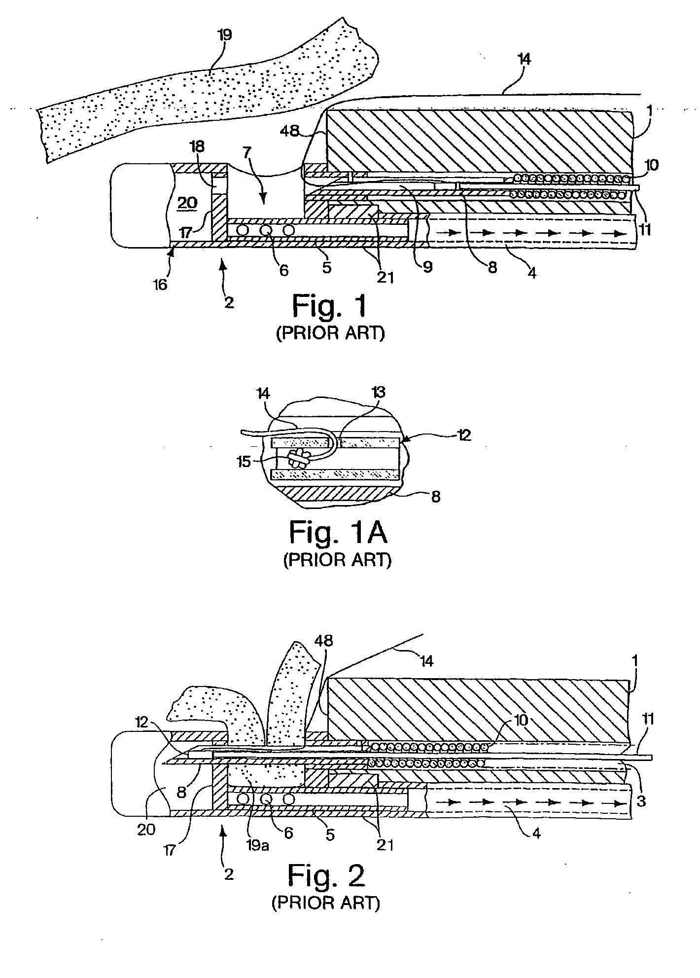Endoscopic tissue apposition device and method of use