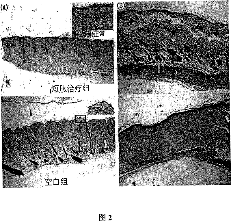 Application of self-assembled short peptide in the medicine for treating burn and face wound