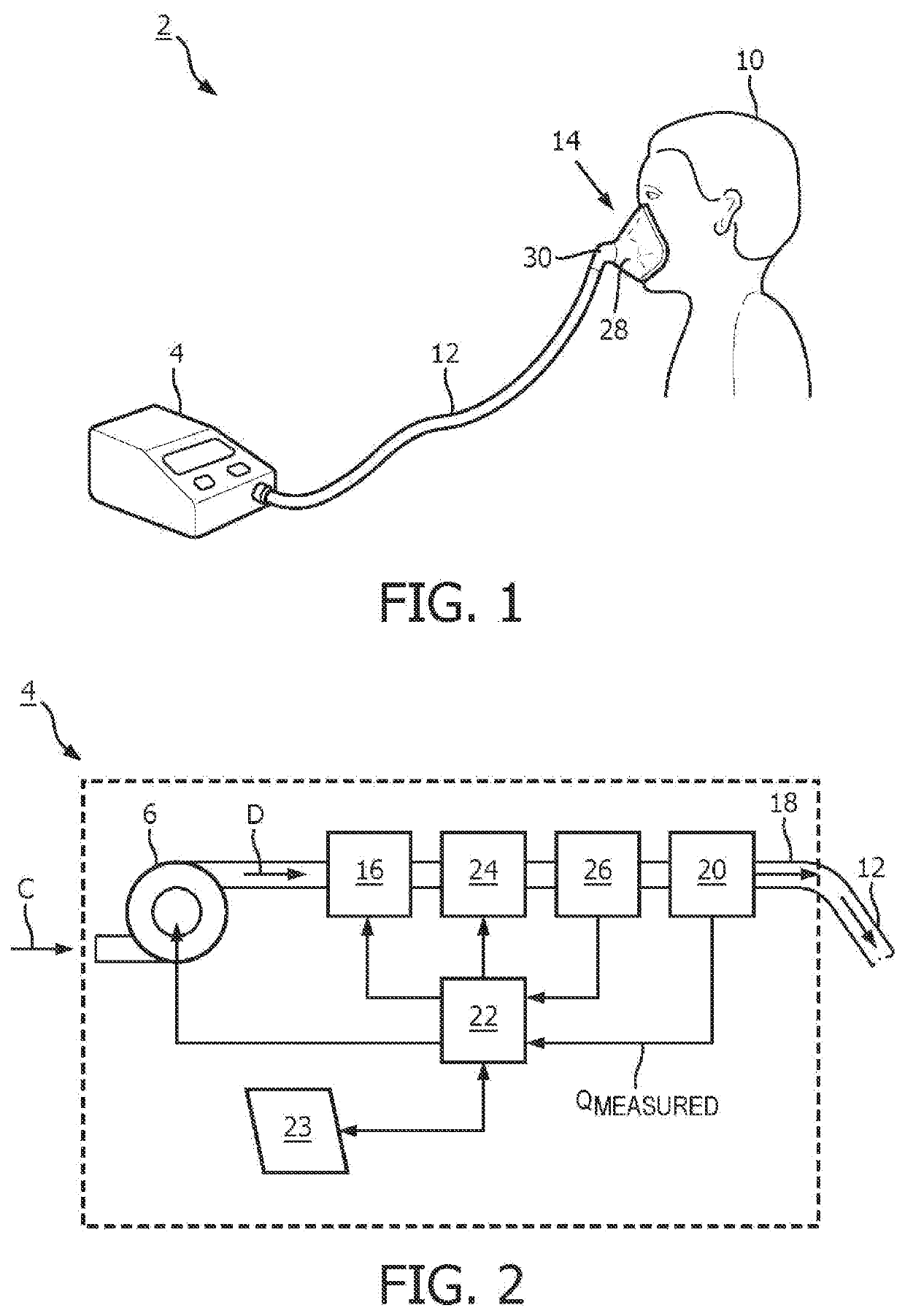 Systems and methods for concurrent airway stabilization and pulmonary stretch receptor activation