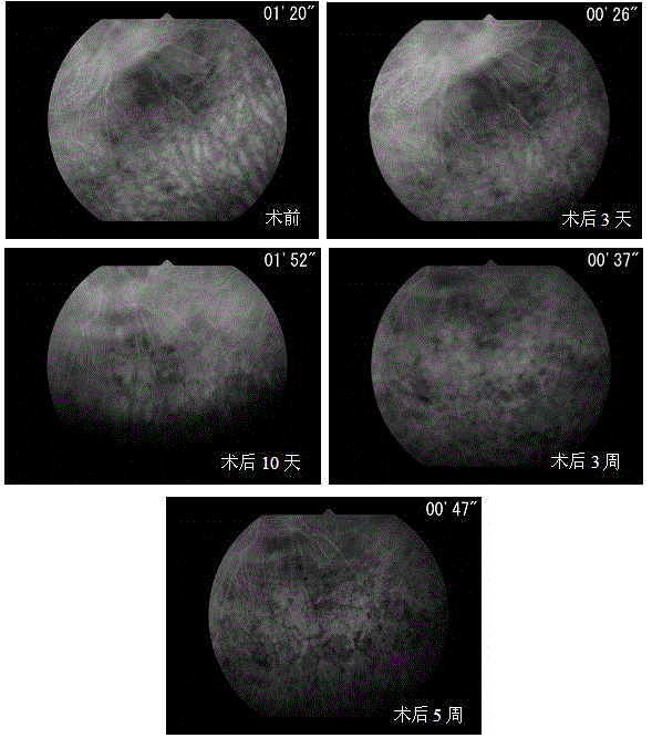 Preparation method of rabbit retinitis pigmentosa model