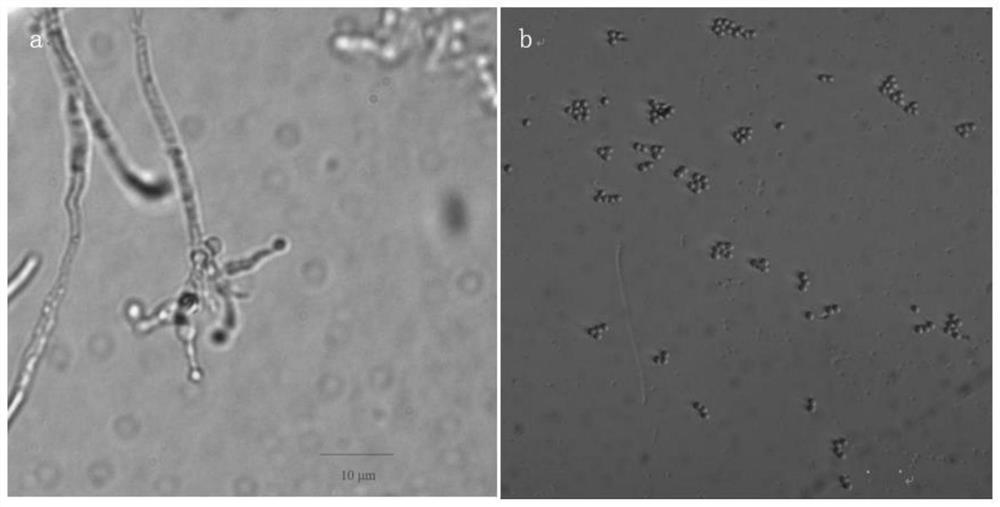 Beauveria bassiana strain with broad-spectrum insecticidal property and application thereof