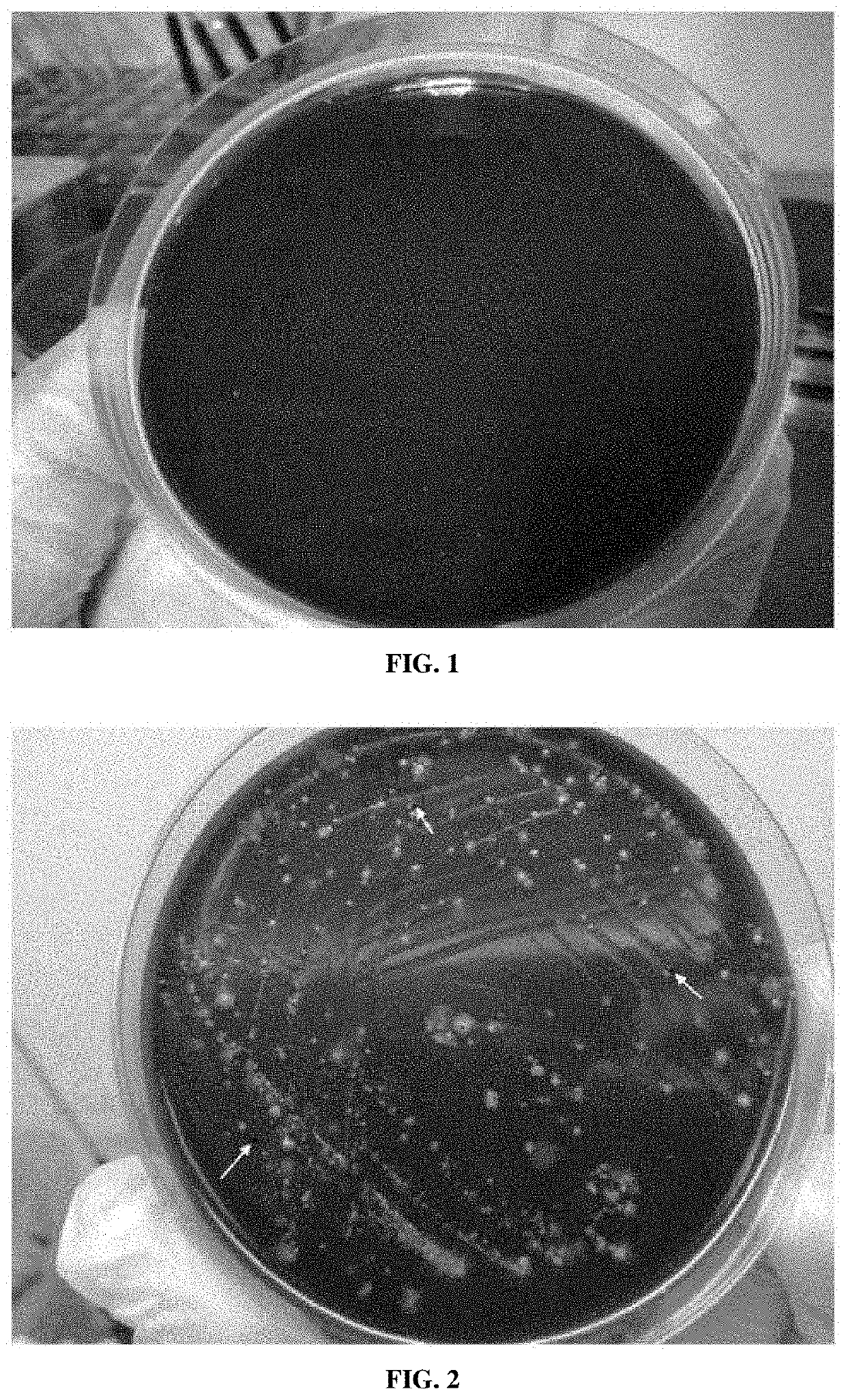 Medium for primary isolation of porphyromonas gingivalis, and a medium for preparing the medium and use thereof