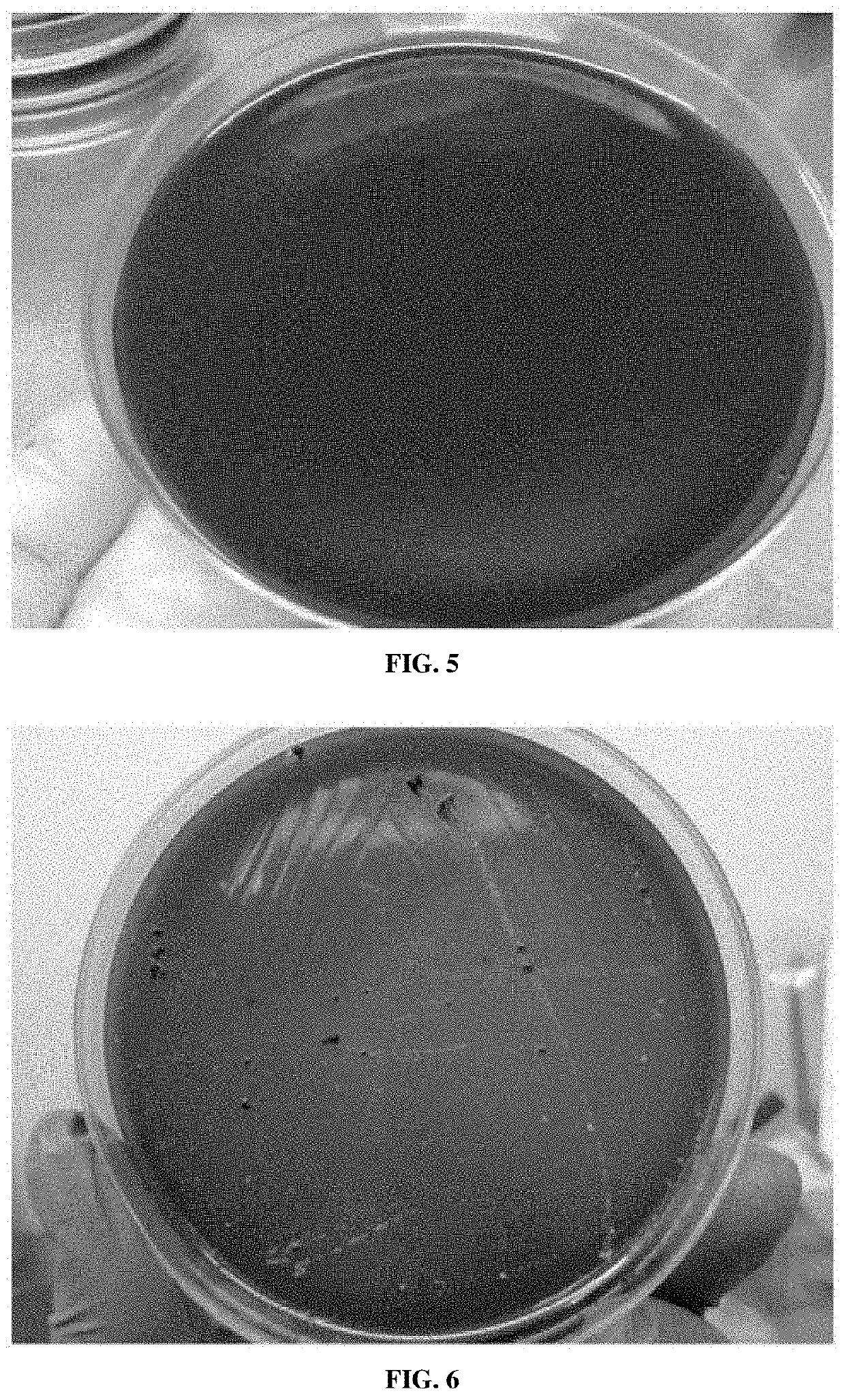 Medium for primary isolation of porphyromonas gingivalis, and a medium for preparing the medium and use thereof