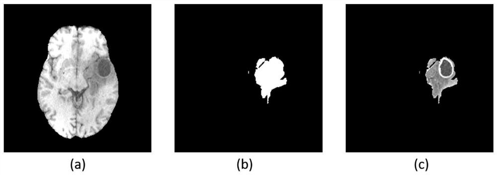 Cascaded U-N Net brain tumor segmentation method combined with wavelet transform