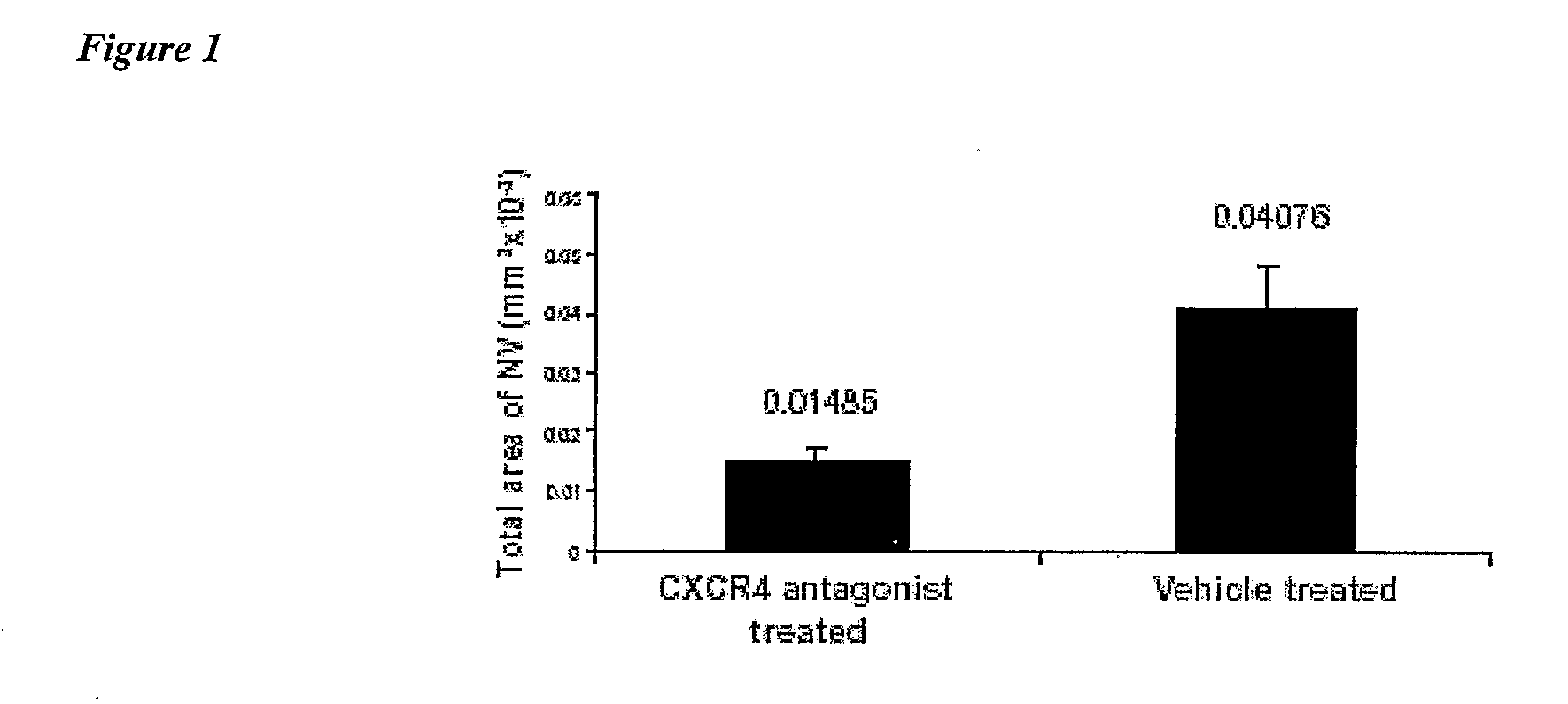 Compositions and Methods for Treating Ophthalmic Diseases