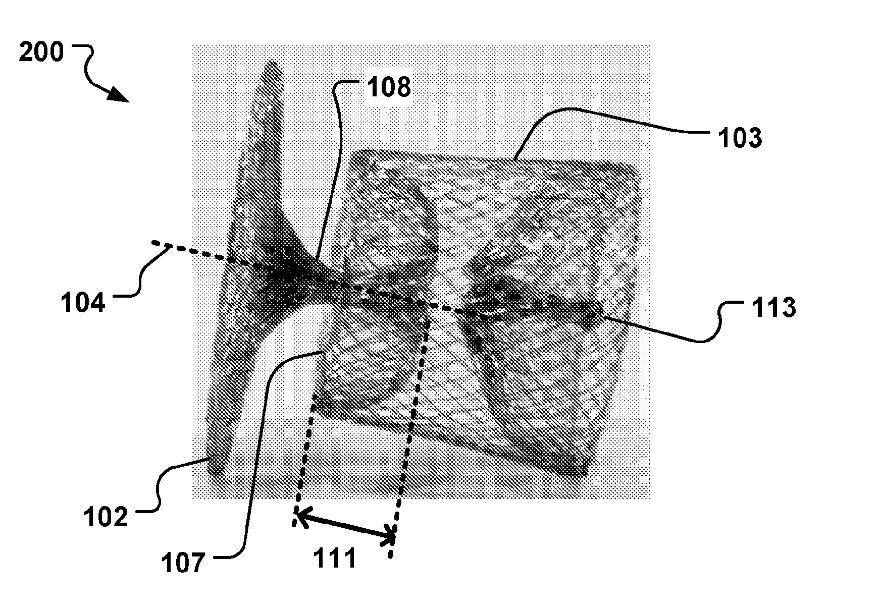 Medical Implant And Manufacturing Method Thereof