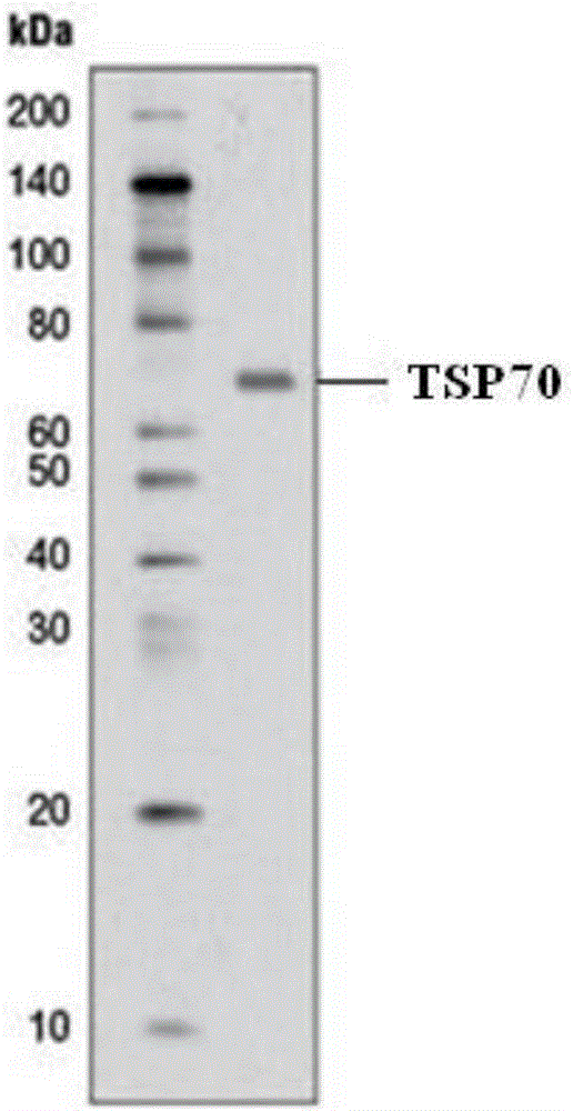 Tumorous specific antigen TSP70 and application thereof