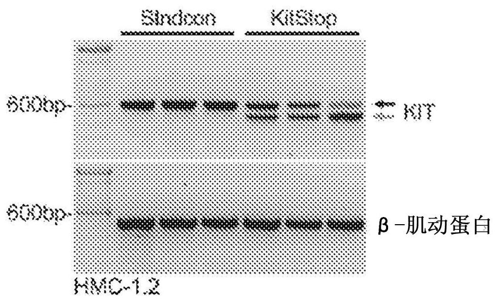 Targeting kit with splice switching oligonucleotides to induce apoptosis of mast cells