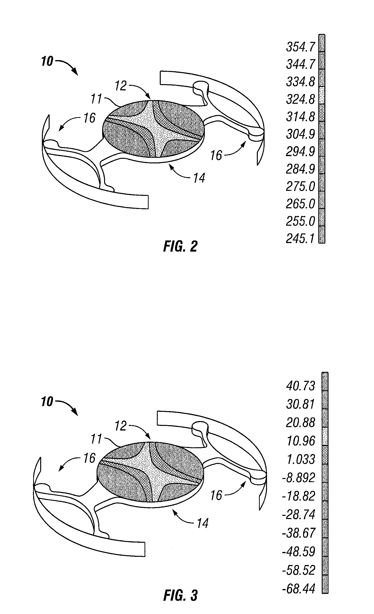 Intraocular lens configured to offset optical effects caused by optic deformation