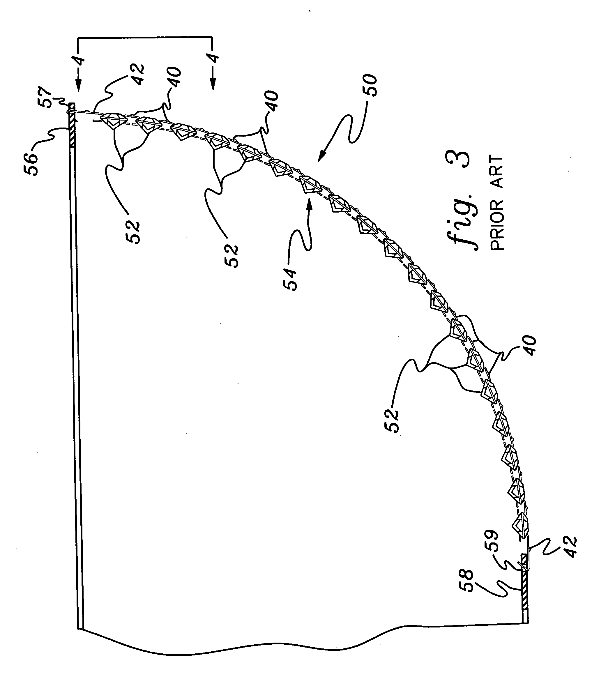 Arrangements and methods for connecting decorative ornaments