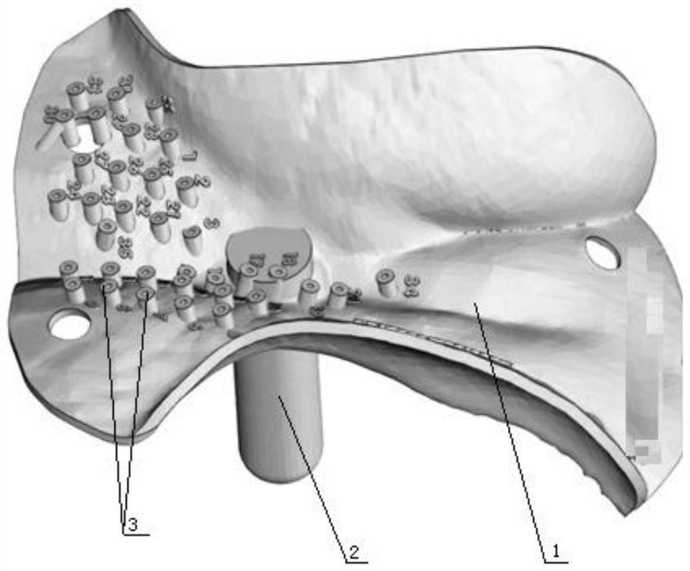 A kind of manufacturing method of gynecological tumor postoperative auxiliary device