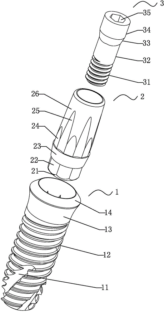 Easily-removing implant device and screwing-out tool thereof
