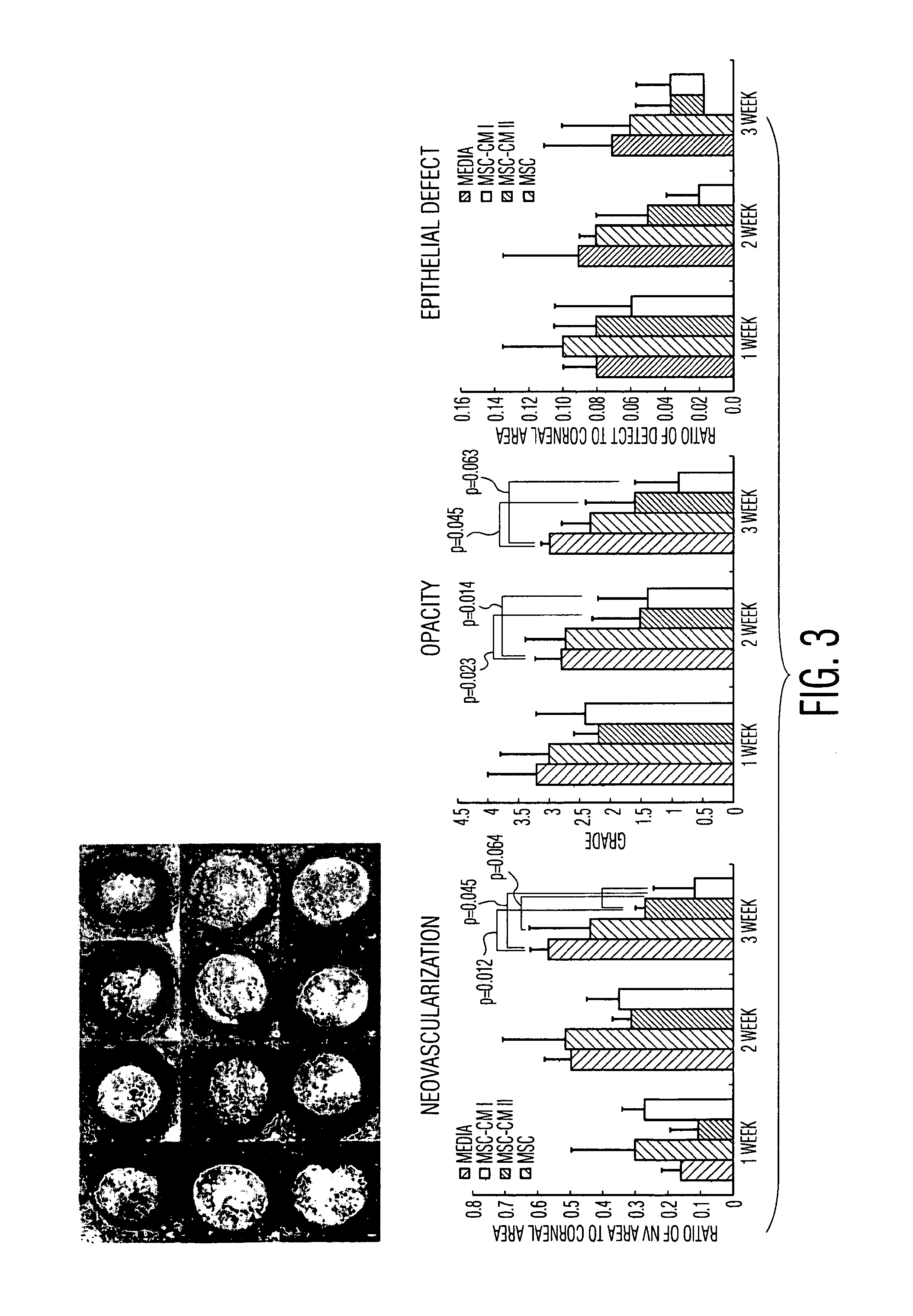 Adult stem cells/progenitor cells and stem cell proteins for treatment of eye injuries and diseases