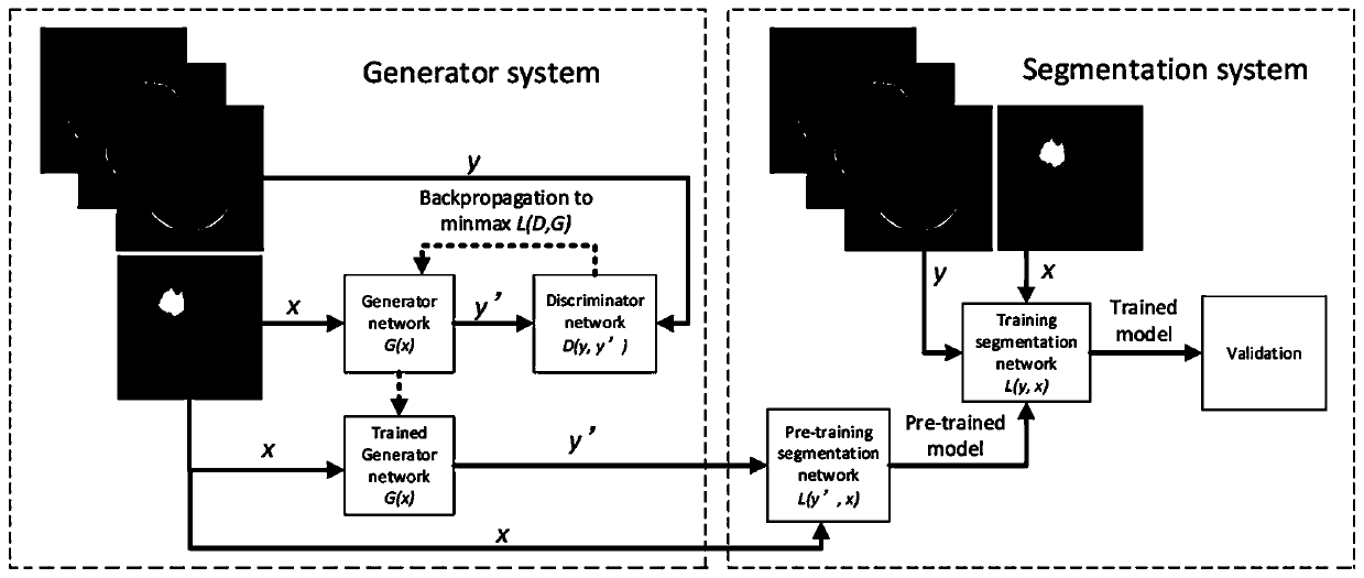 MR image segmentation method and device based on conditional generative adversarial network