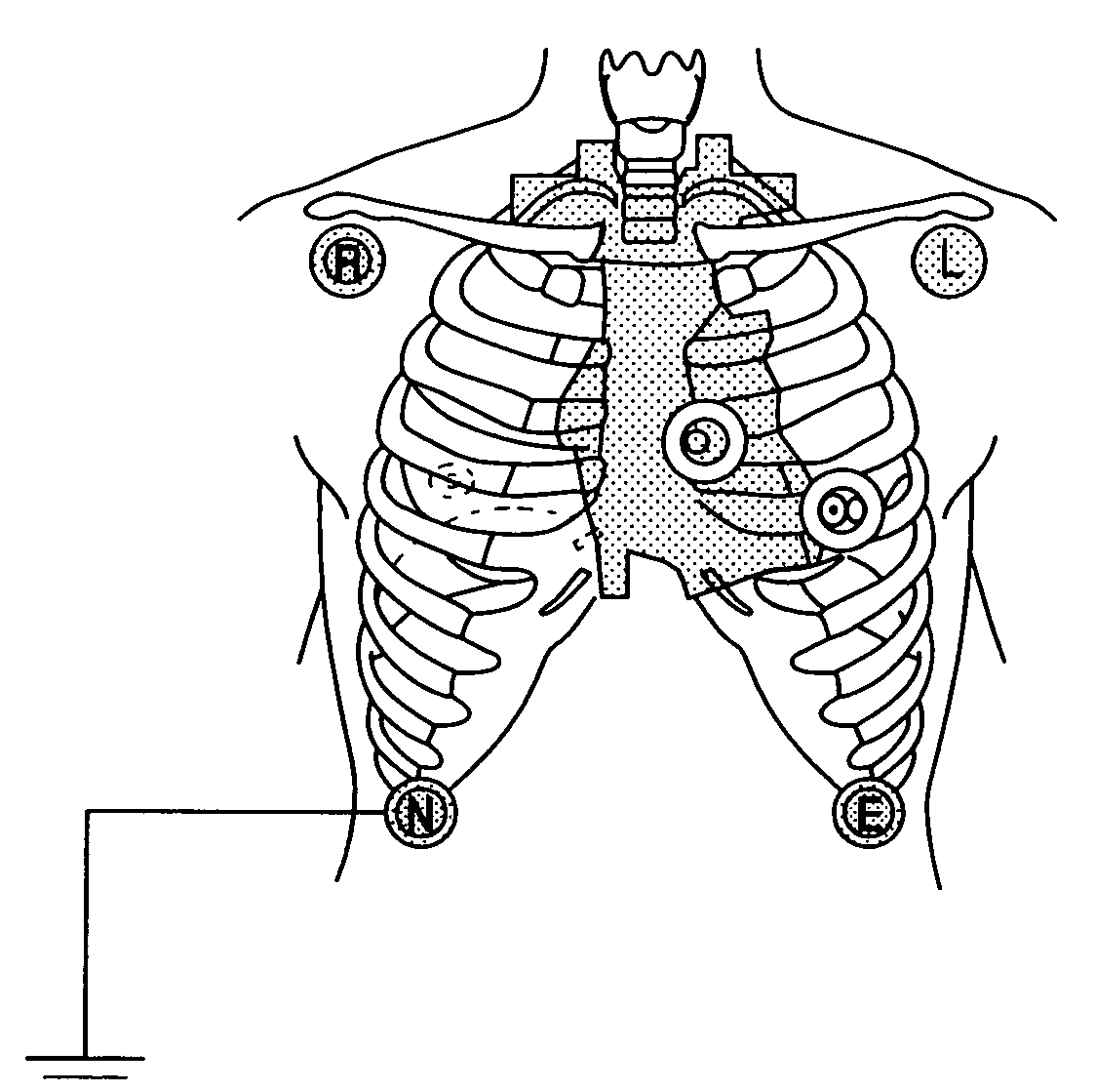 Method for deriving standard 12-lead electrocardiogram, and monitoring apparatus using the same