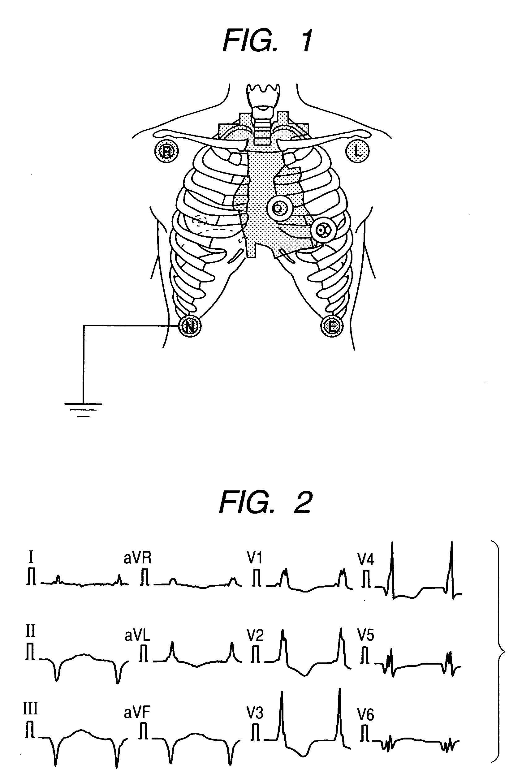 Method for deriving standard 12-lead electrocardiogram, and monitoring apparatus using the same