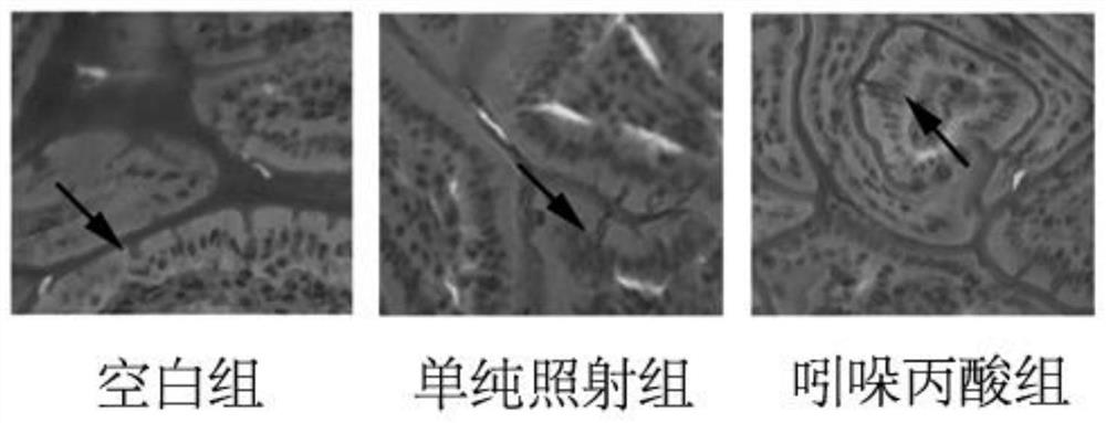 Use of indolepropionic acid in the preparation of medicines for preventing and/or treating side effects of tumor radiotherapy