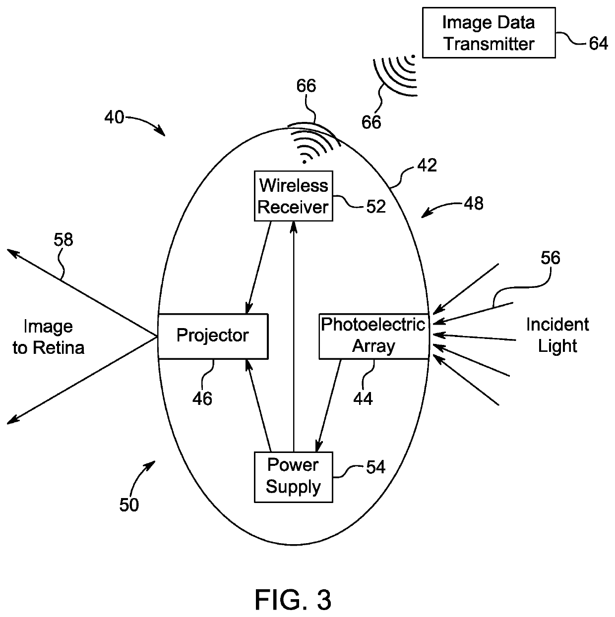 Artificial vision intraocular implant device