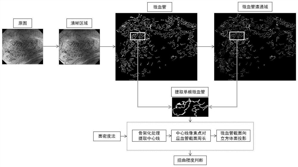 Microvascular distortion degree quantification method for gastric mucosa dyeing amplification imaging