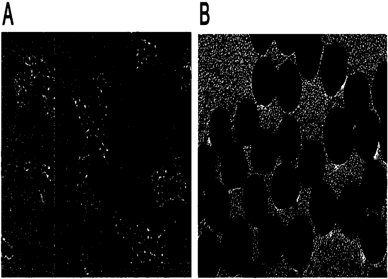 LC-MS (Liquid Chromatograph-Mass Spectrometer) quantitative method for detecting protein drug in body on basis of label small molecule exclusive separation-amplification and application of protein drug