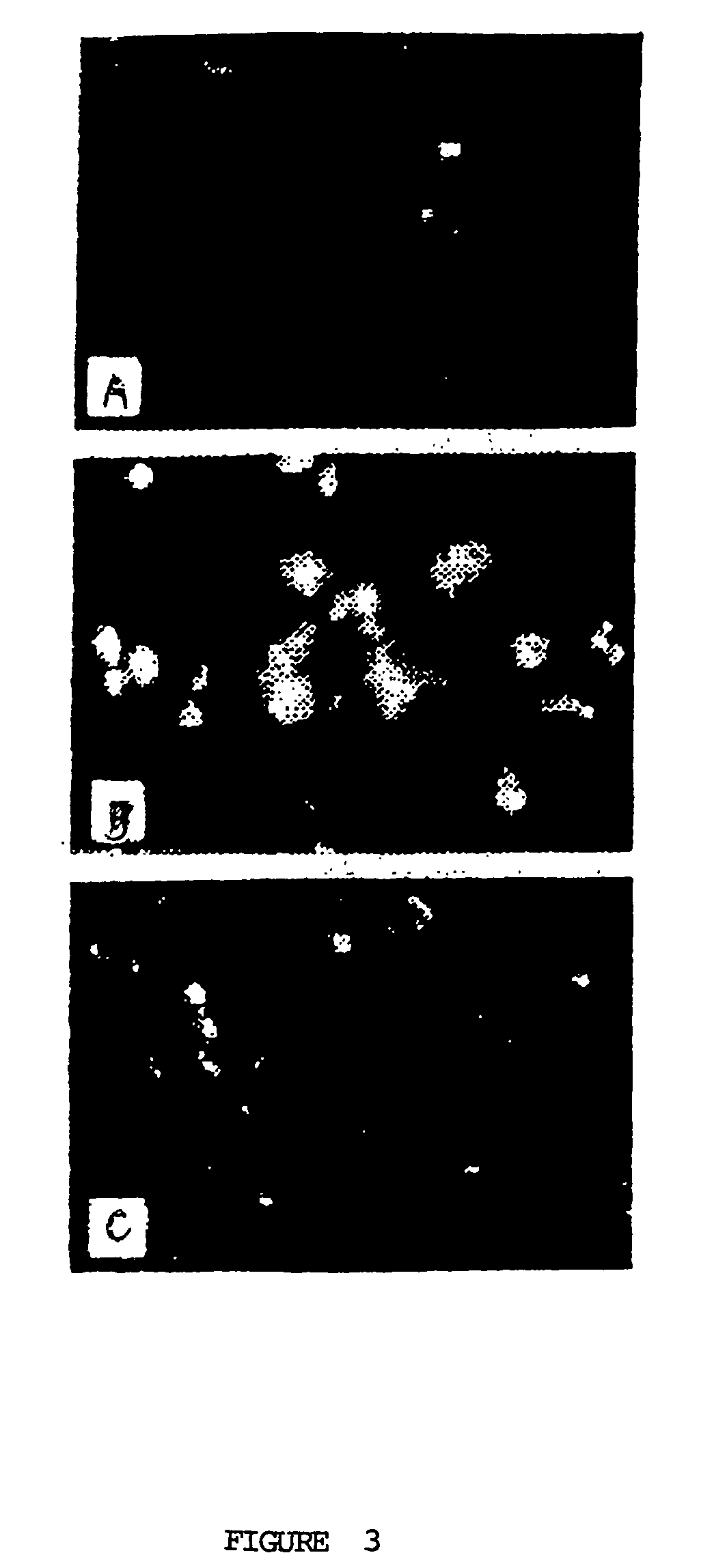 Facile detection of polycythemia vera