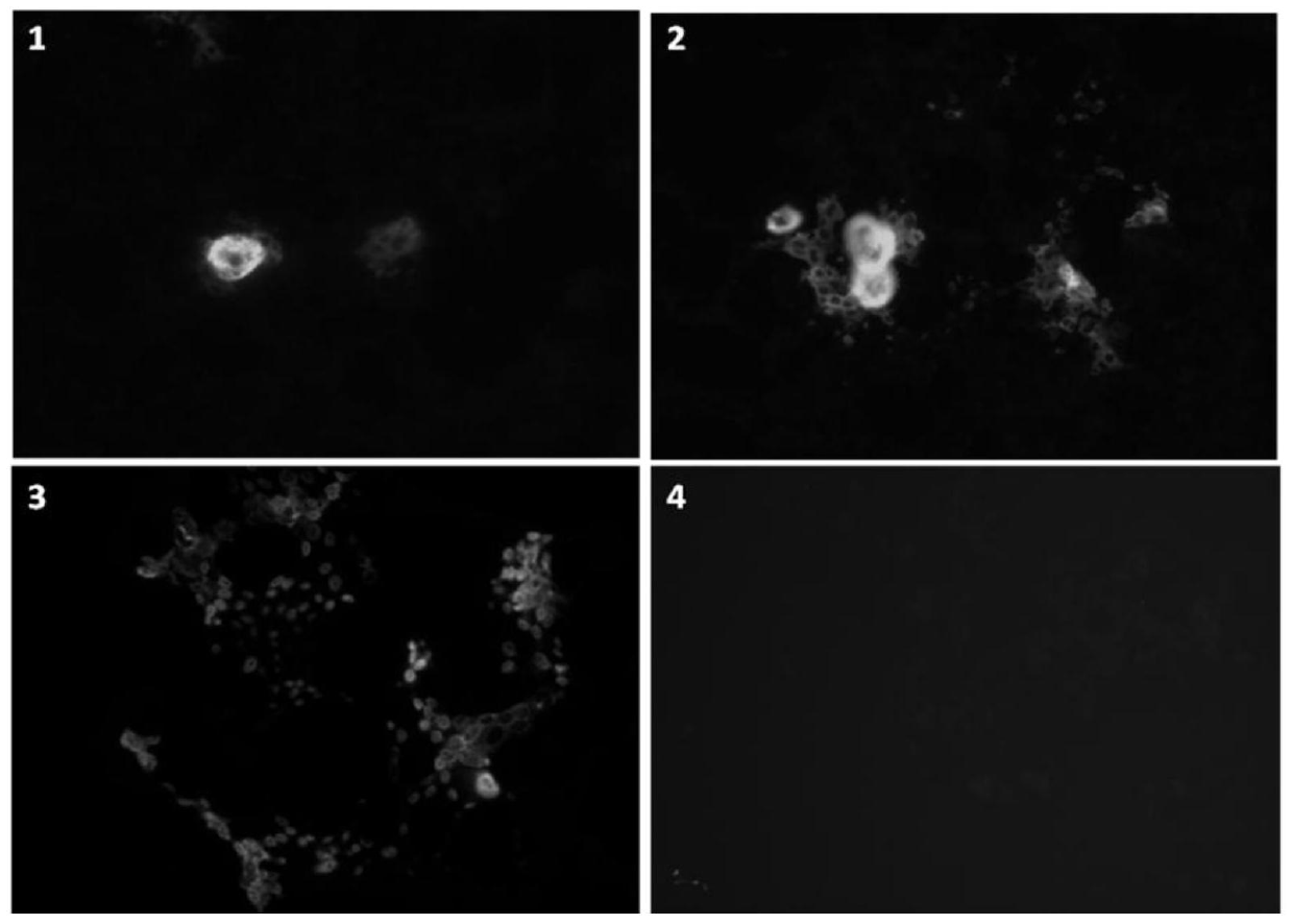 A kind of anti-porcine epidemic diarrhea virus s protein hybridoma cell line and its application