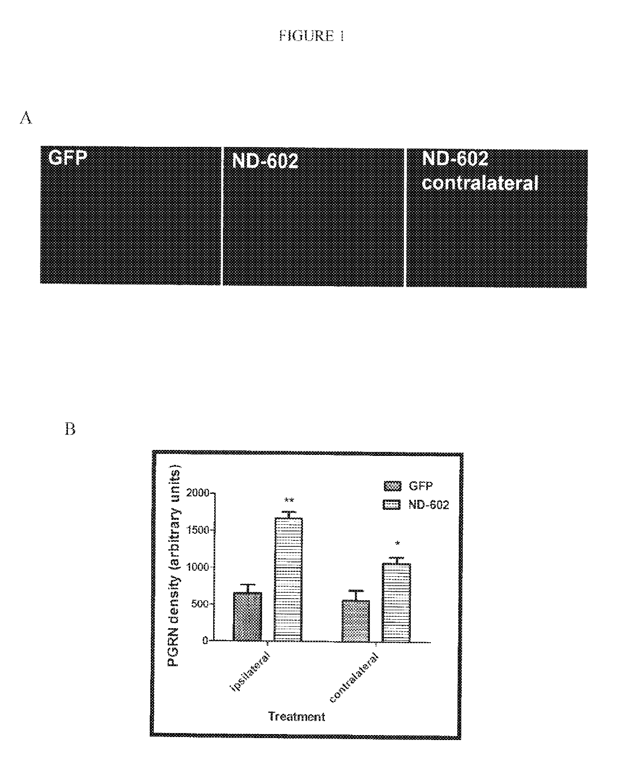 Method for increasing neprilysin expression and activity