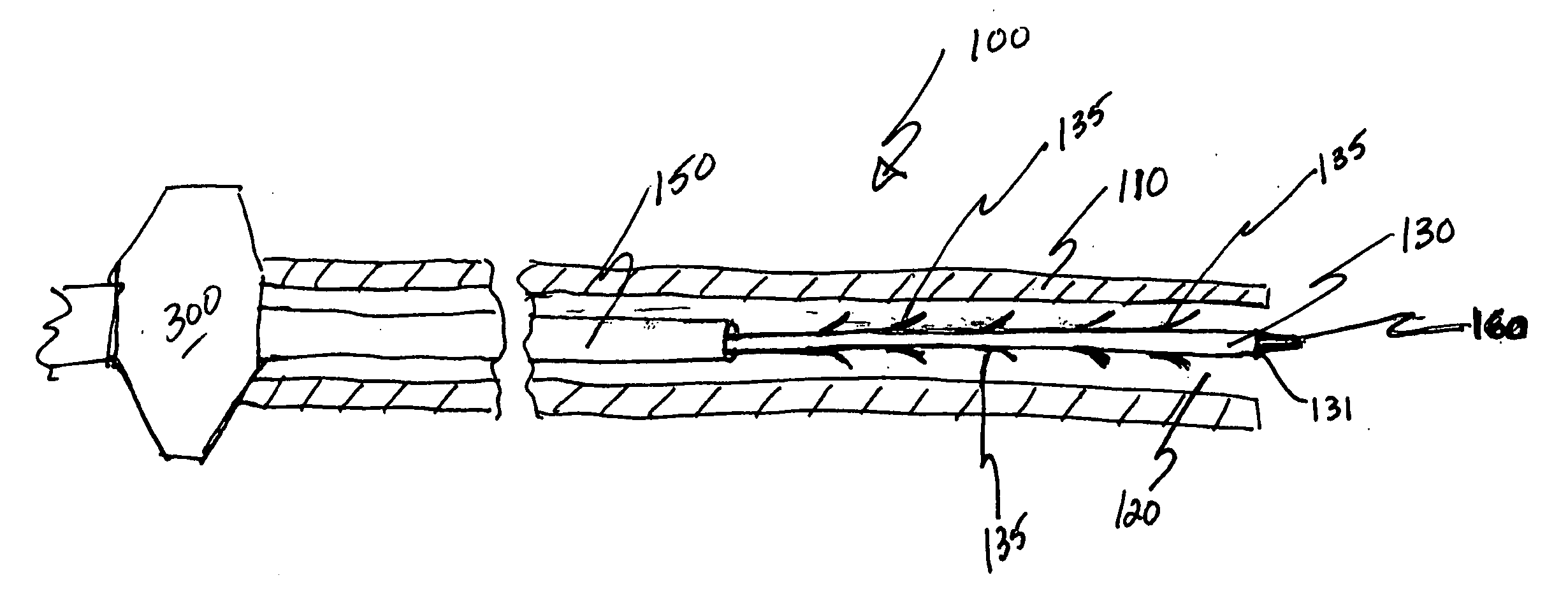 Stent delivery system with improved delivery force distribution
