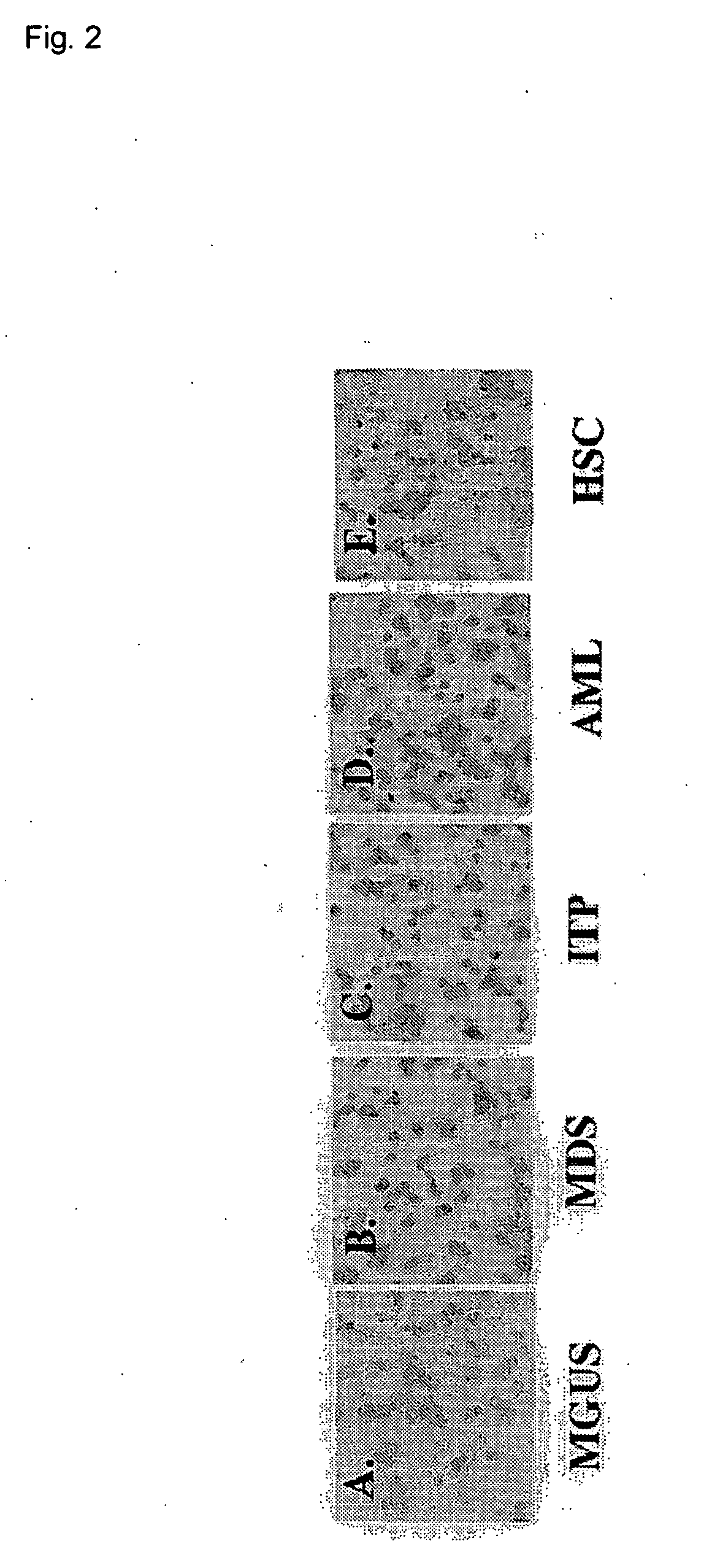 Method of inhibiting production of osteopontin