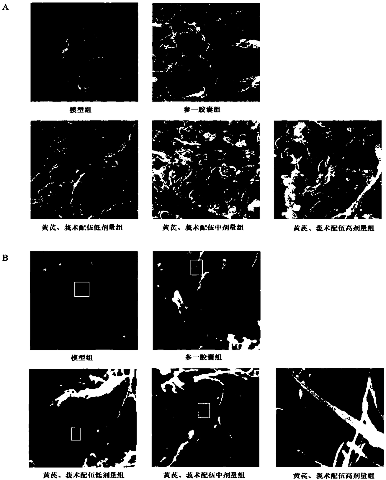 Traditional Chinese medicine composition with effect of promoting normalization of tumor vessel and preparation method and application thereof