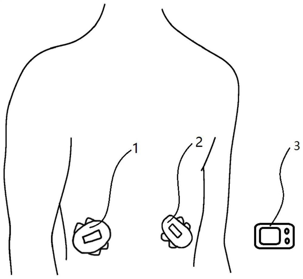 A Closed-loop Control Algorithm for Artificial Pancreas