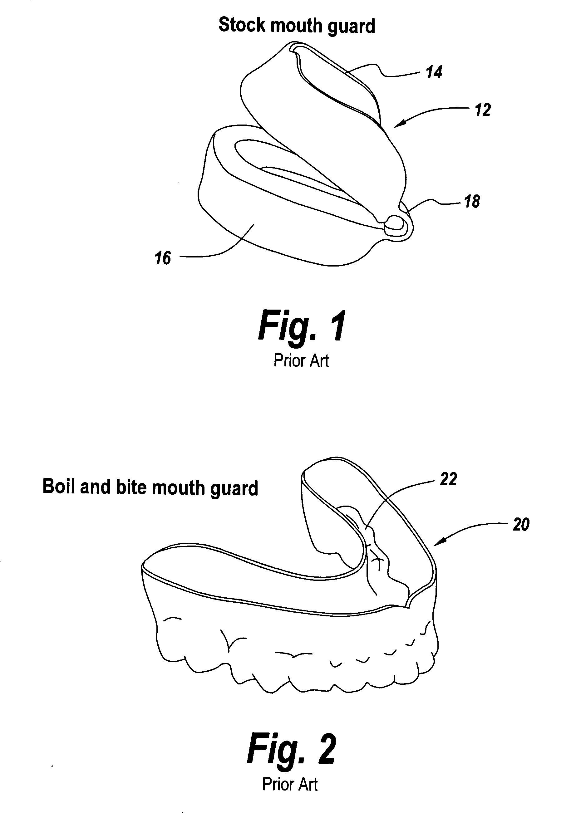 Method and apparatus for protecting teeth, preventing the effects of bruxism and protecting oral structures from sports injuries