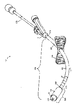 Systems and methods for internal bone fixation