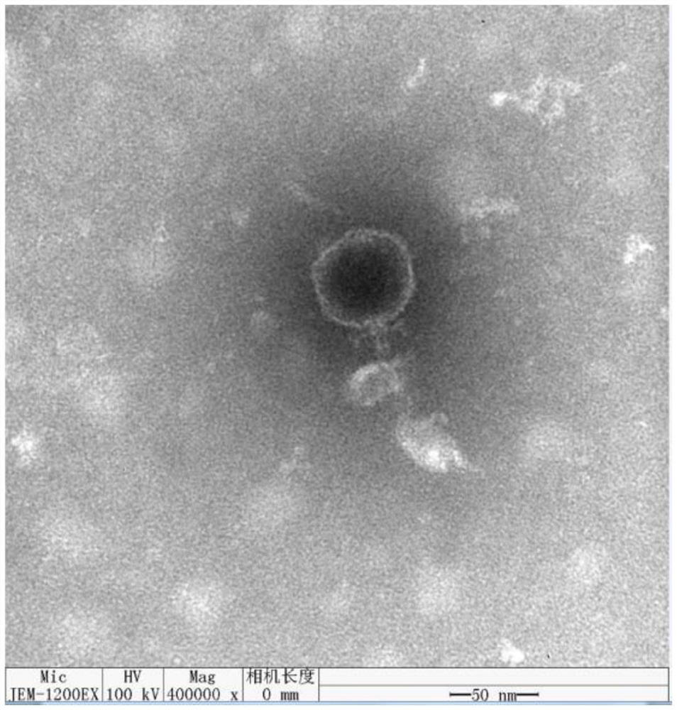 Pseudomonas syringae phage and composition, kit and application thereof