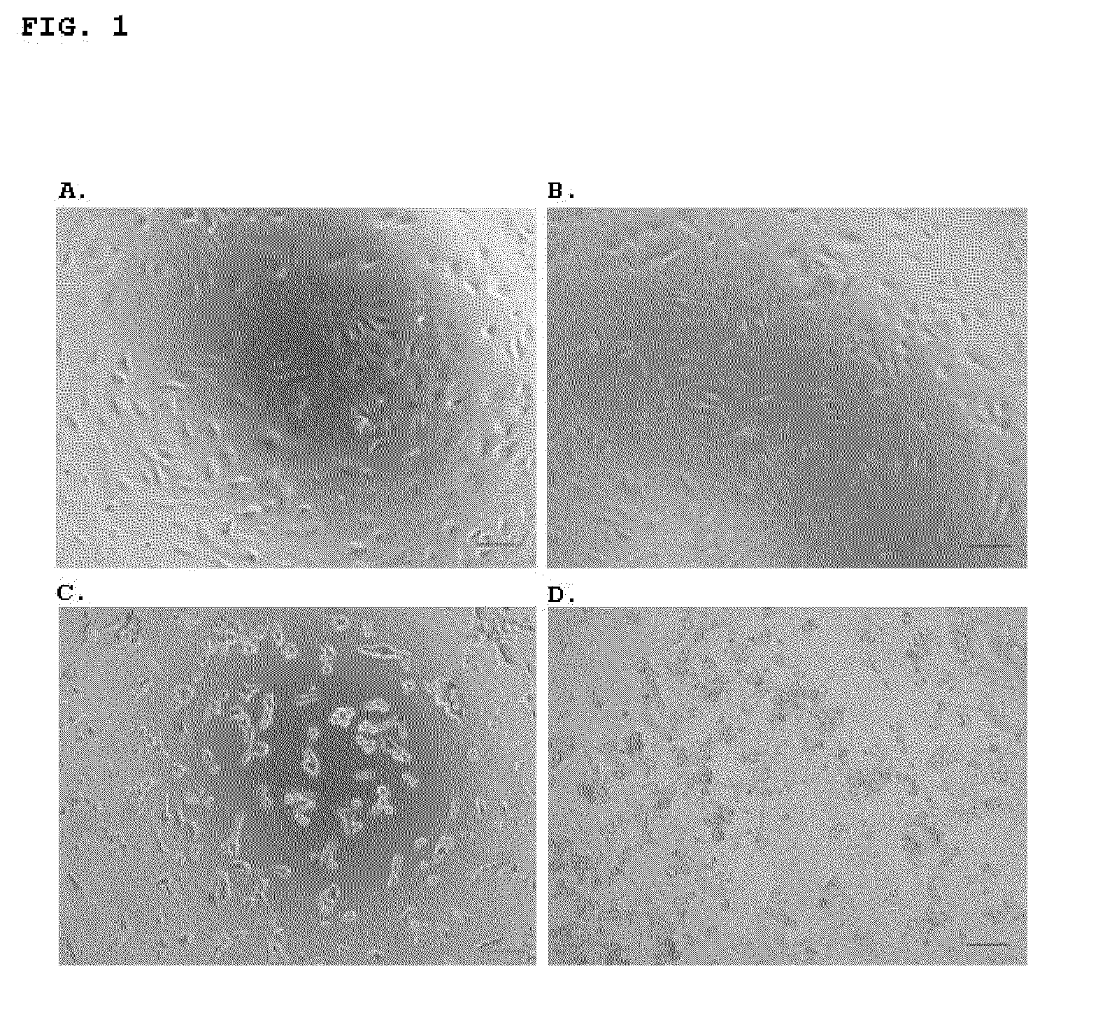 Pharmaceutical compositions containing the enzyme cyprosin, an aspartic peptidase from cynara cardunculus and its inclusion in antitumour formulations